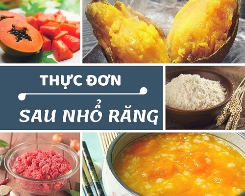 nhổ răng khôn đau mấy ngày